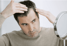 Переваги трансплантації волосся при алопеції